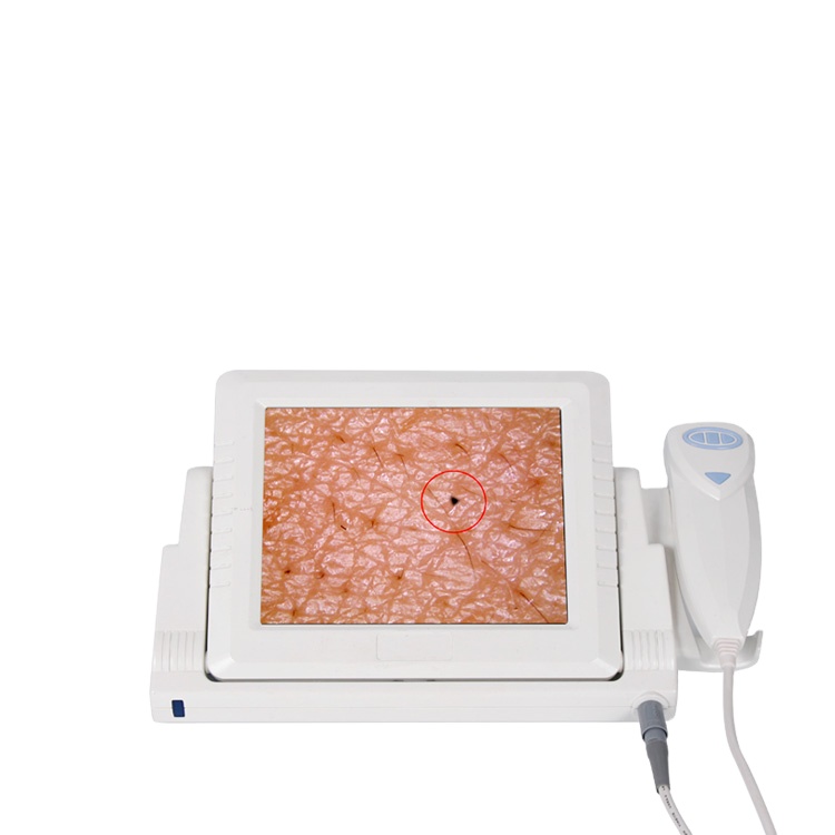 2018 Hotselling Digital Camera Skin Analyzer System 