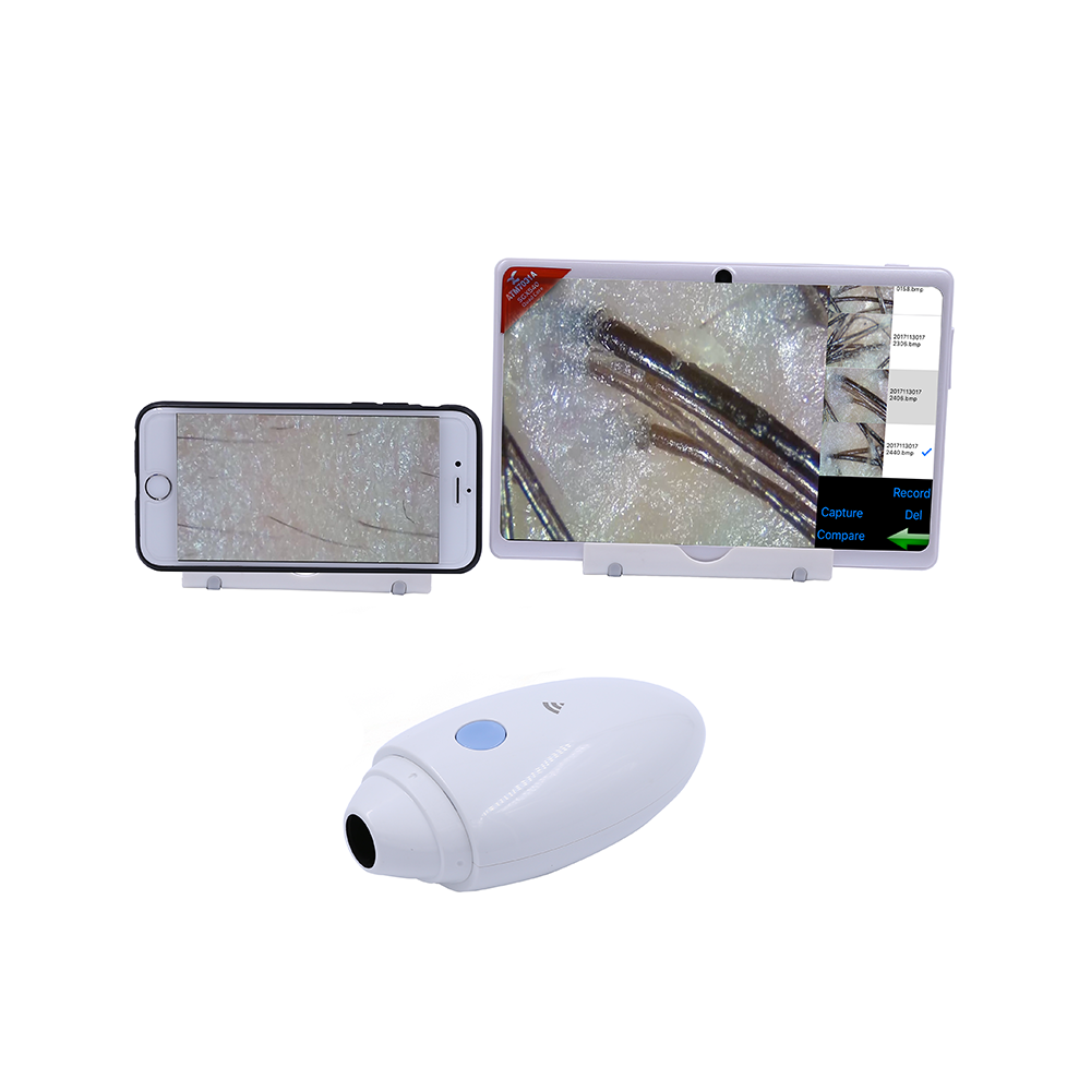 High Quality Wifi Skin Scalp Analyzer For Home Use 